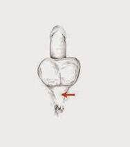 အာမစ်ကြွက်သားများနှင့်ဆန့်ကျင်မှုကိုတိုးပွားစေရန်၎င်းတို့၏တင်းမာမှု